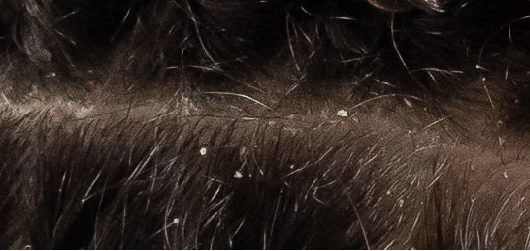How to Remove Hair Buildup