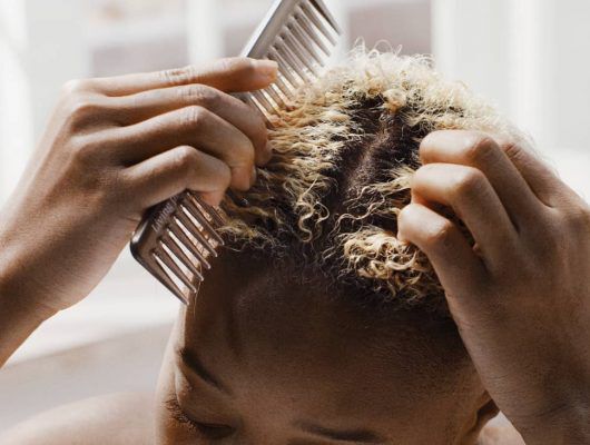 8 Dry Scalp Treatment Remedies [+ Causes & Prevention Tips]