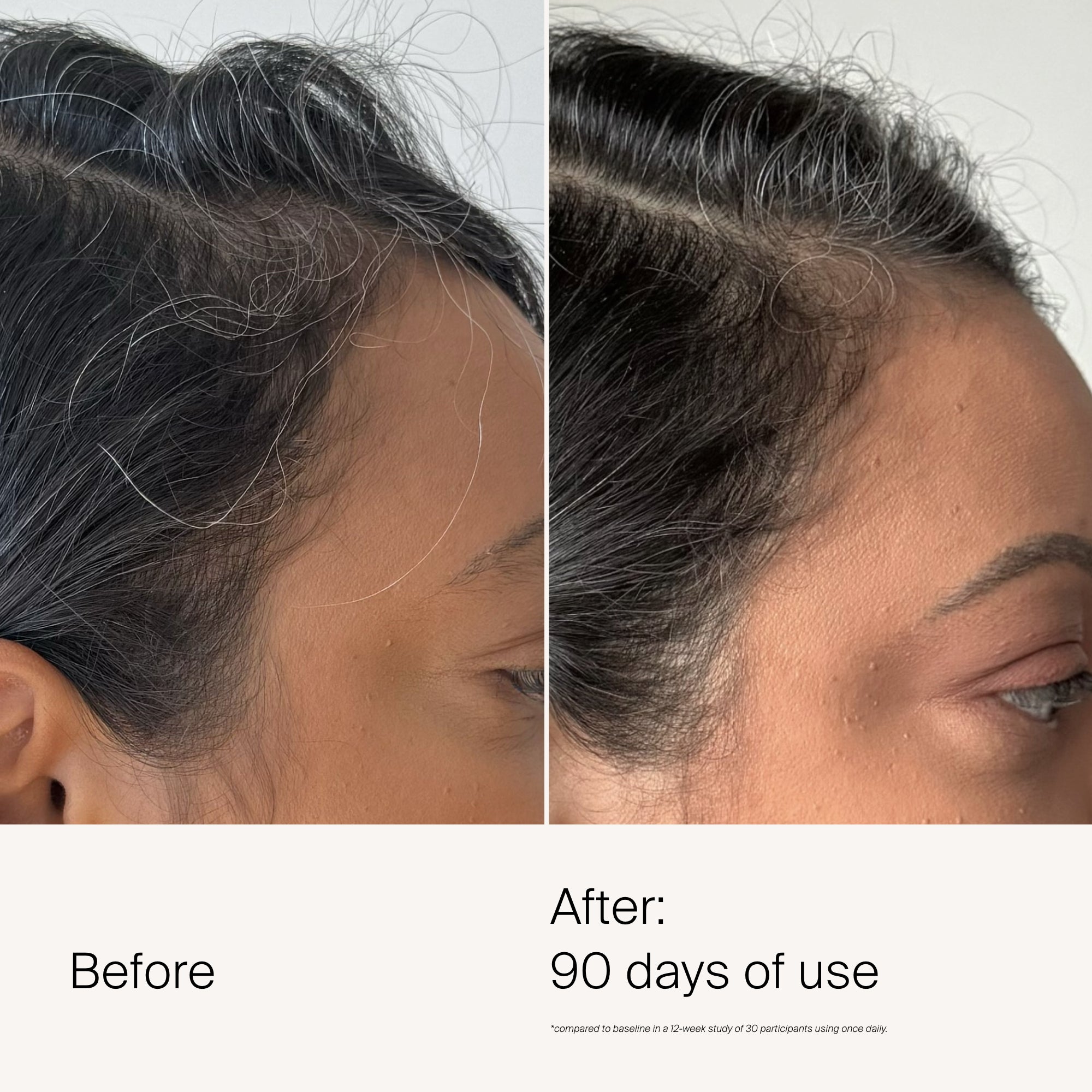 Scalp Care Dry Scalp Treatment