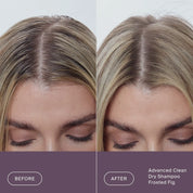 Close-up of a person’s scalp and hair, showing oily roots on the left (Before) and clean, refreshed roots on the right (After) with Perfect hair Day™ Frosted Fig Advanced Clean Dry Shampoo—a limited-edition formula that infuses your hair with fig and coconut freshness.