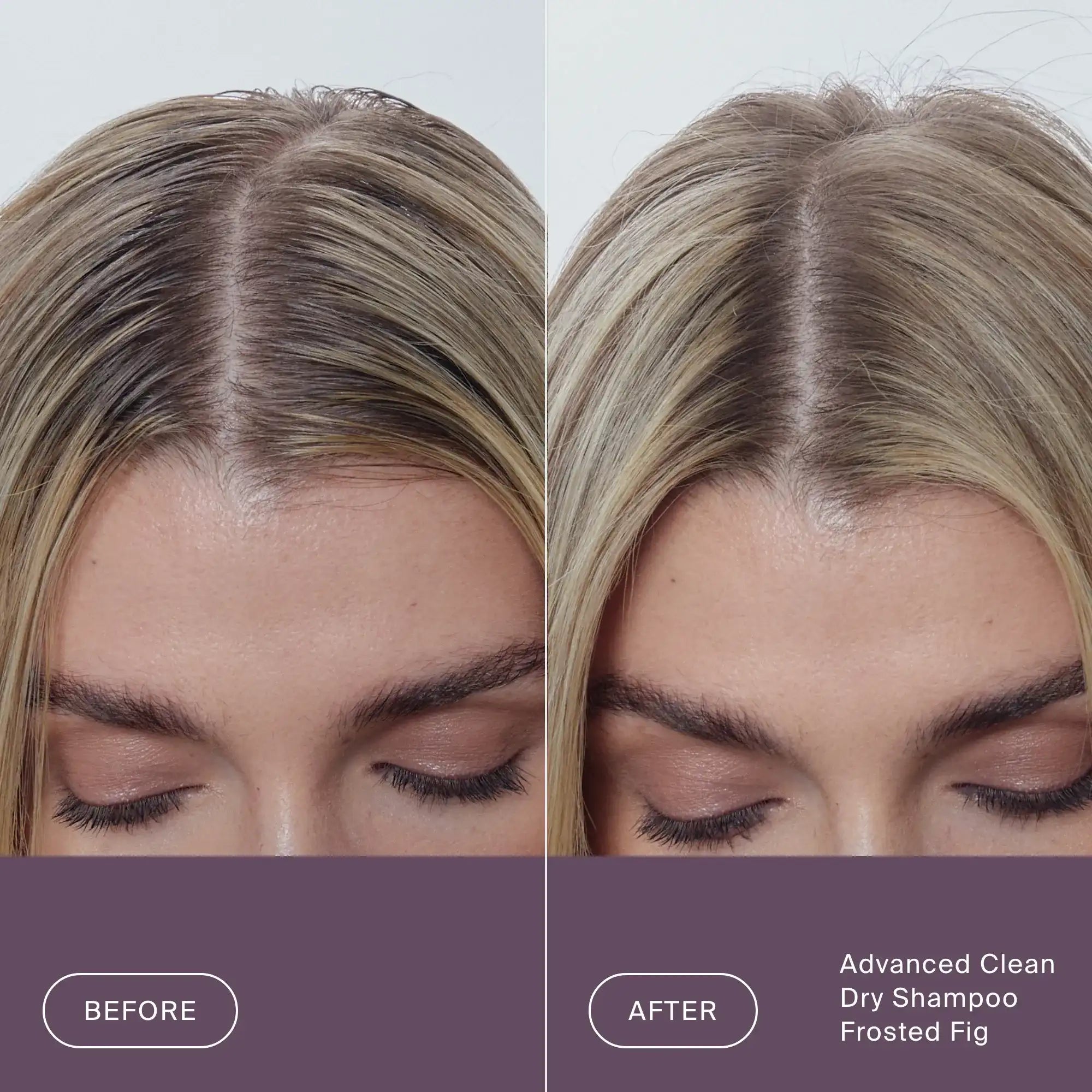 Close-up of a person’s scalp and hair, showing oily roots on the left (Before) and clean, refreshed roots on the right (After) with Perfect hair Day™ Frosted Fig Advanced Clean Dry Shampoo—a limited-edition formula that infuses your hair with fig and coconut freshness.