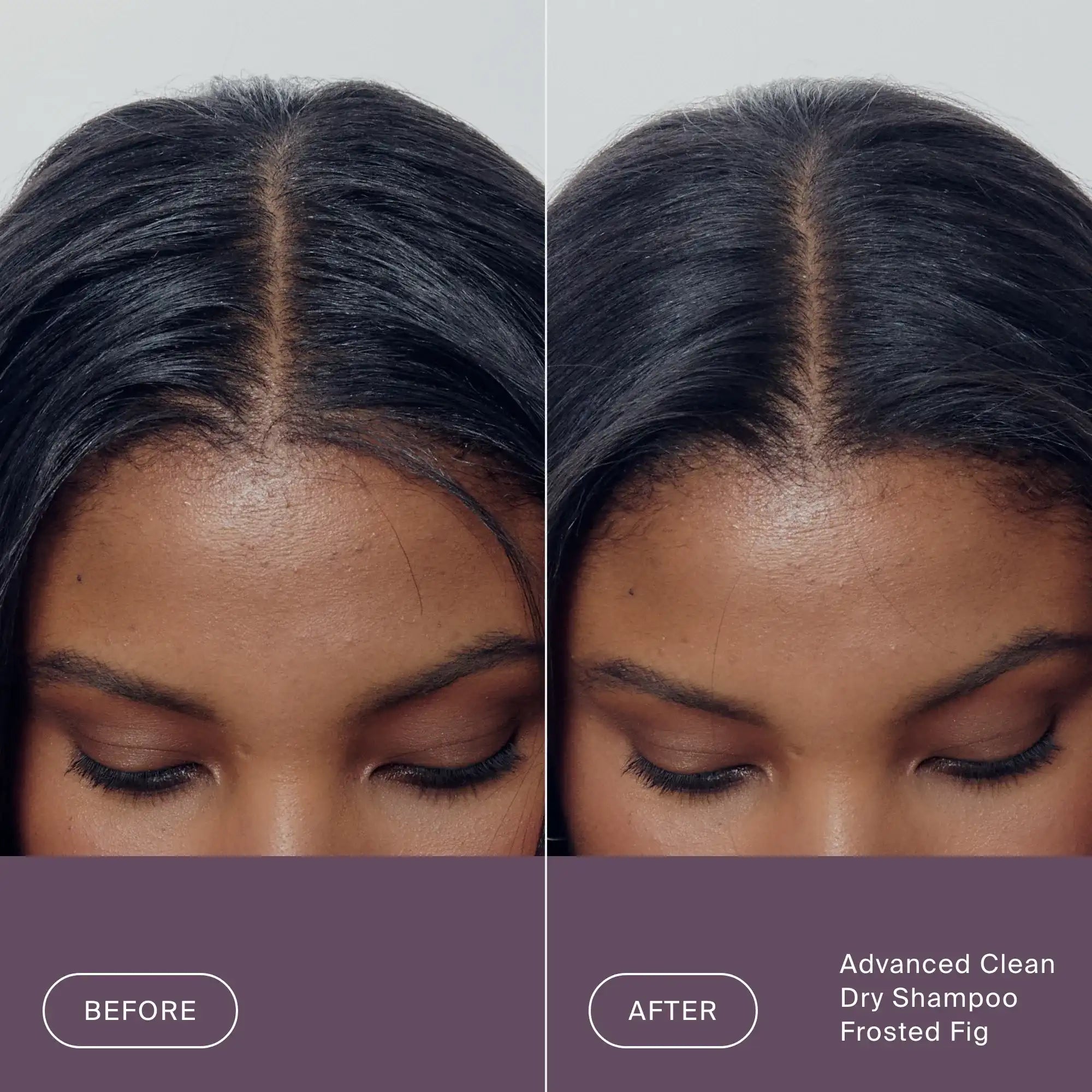 A woman’s scalp shown before and after using Perfect hair Day™ Frosted Fig Advanced Clean Dry Shampoo. The after image displays cleaner, less oily hair along the part, highlighting the refreshing results of this limited-edition dry shampoo.