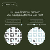 Diagram showing the difference between an unbalanced and balanced microbiome on a scalp, with text about dry scalp treatment.
