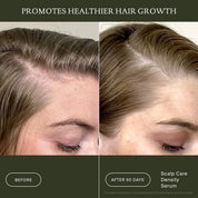 Before and after comparison of scalp care density serum on hair growth.