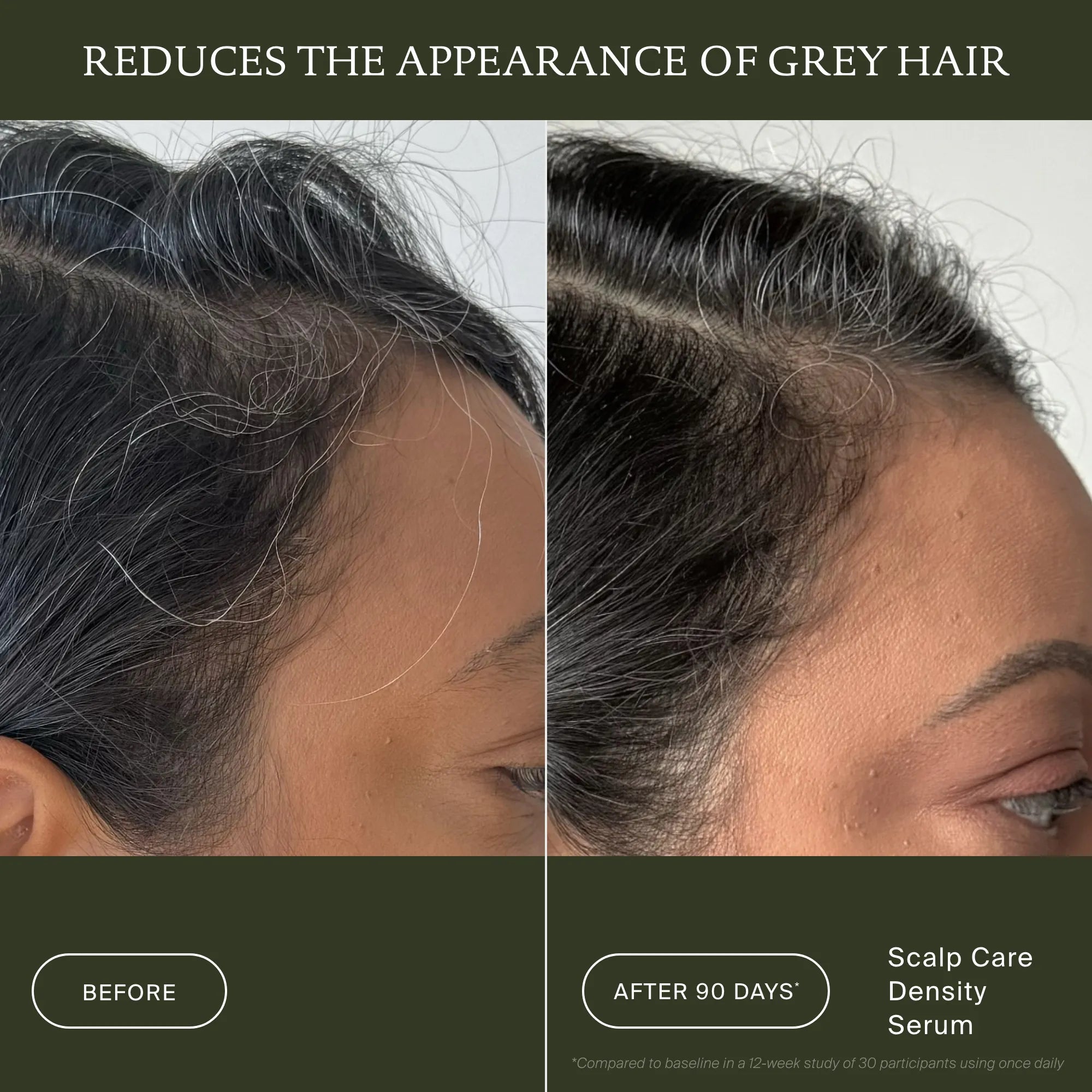 Before and after comparison of scalp care density serum with text indicating reduction of gray hair.