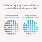 Dry Scalp Treatment  hi-res