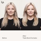 bond-building treatment