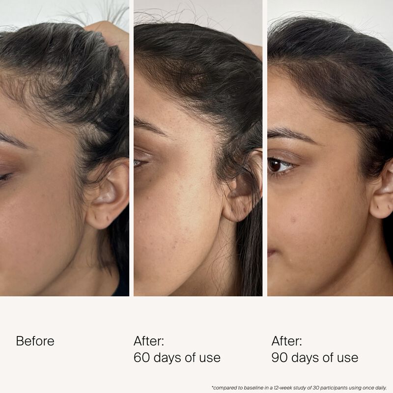 Living Proof Scalp Care Density Serum 50ml Living Proof Scalp Care Density Serum 50ml